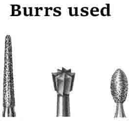 3 types of engraving burrs